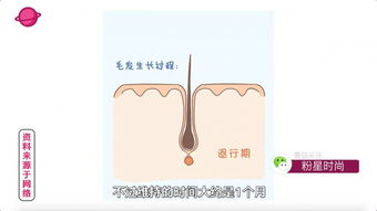 万人精选 强脉冲脱毛仪——实用与高效的脱毛首选